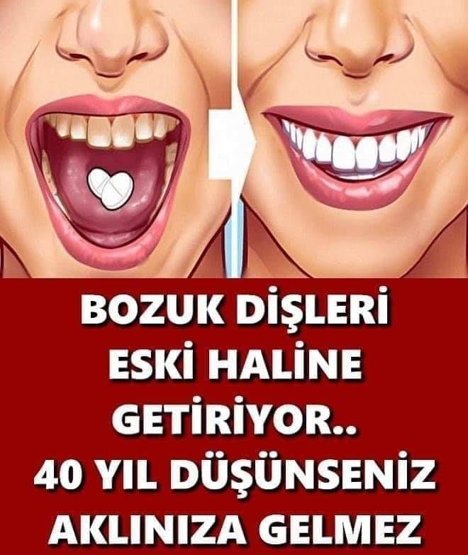 BOZUK DİŞLERE MUHTEŞEM ÇÖZÜM.. 