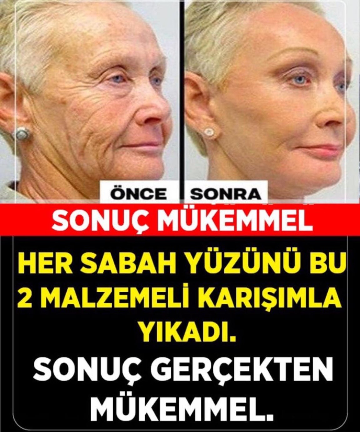 HER SABAH YÜZÜNÜ BU 2 MALZEMELE İLE YIKADI VE SONUÇ.. 