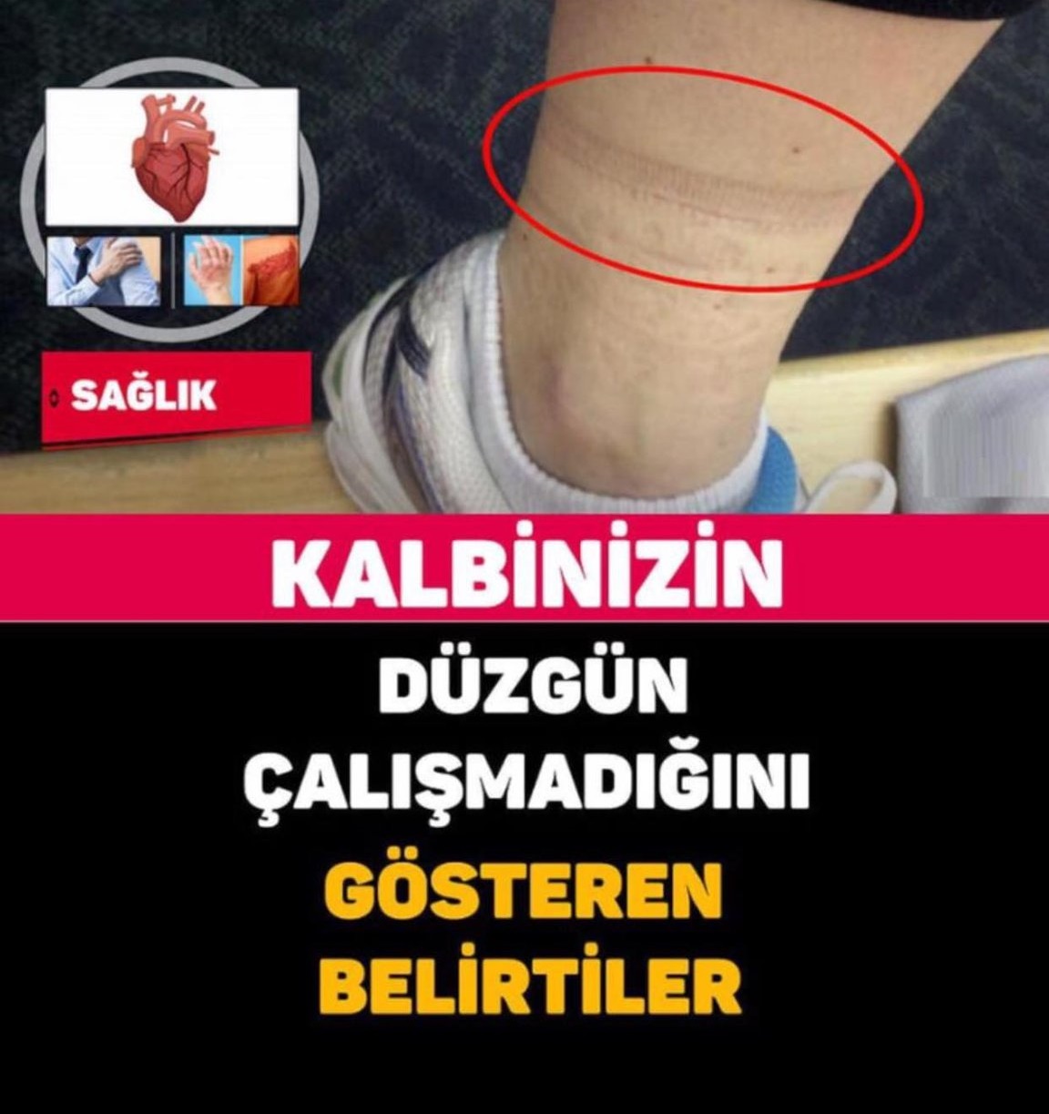 KALBİNİZİN DÜZGÜN ÇALIŞMADIĞINI GÖSTEREN BELİRTİLER ..