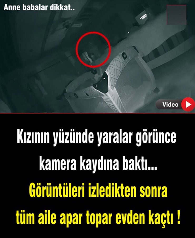 Kızının Yüzünde Yaralar Görünce Kamera Kaydına Baktı